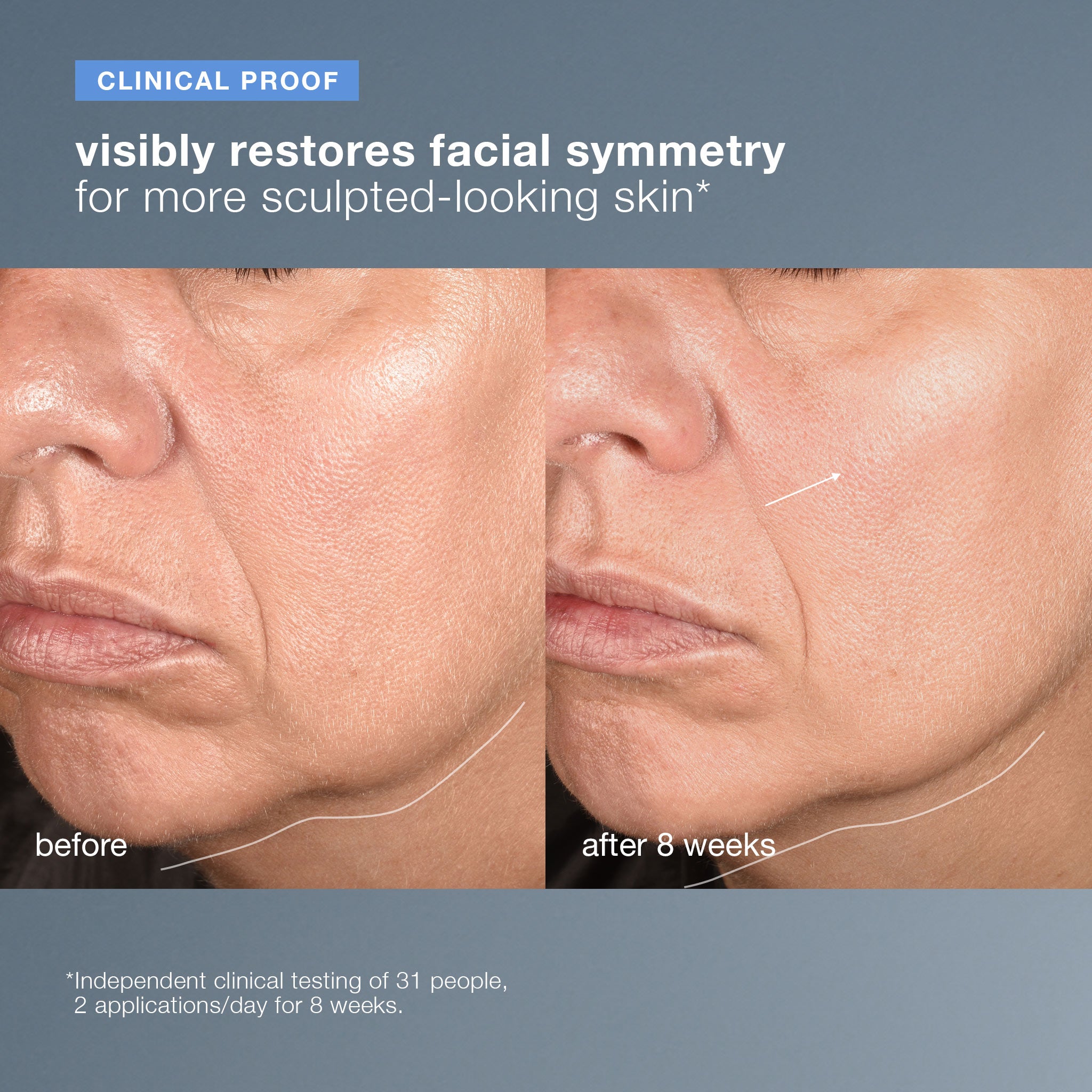 neurotouch symmetry serum - gift - rewards store
